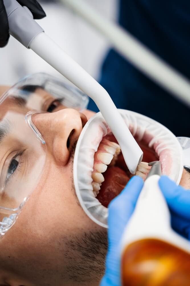 higienizacja-stomatologiczna